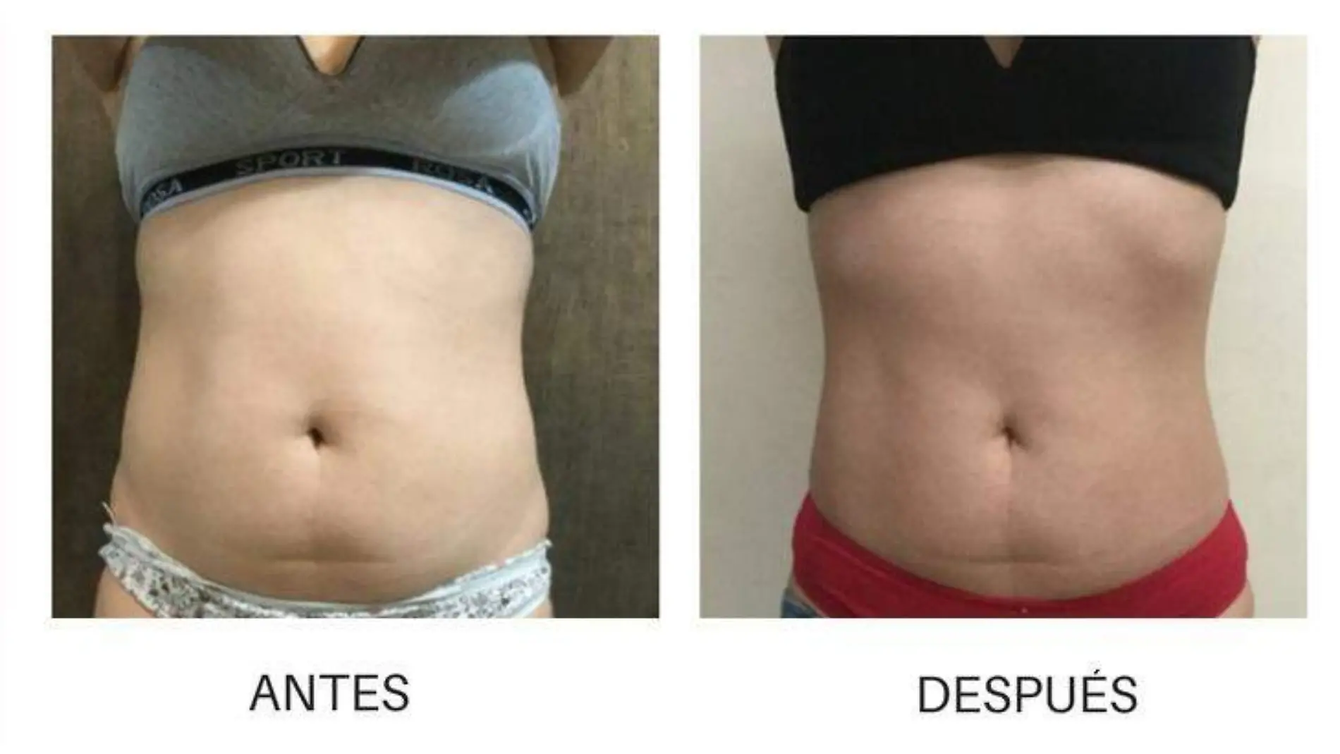 antes y despues